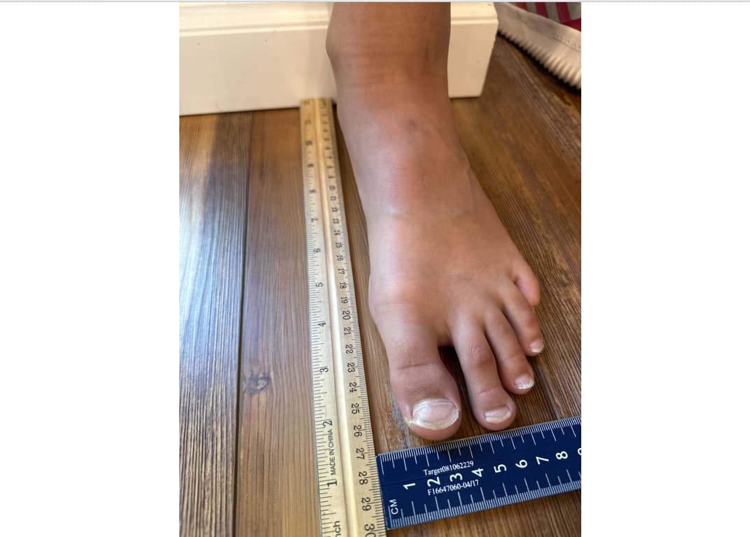 Largest Foot