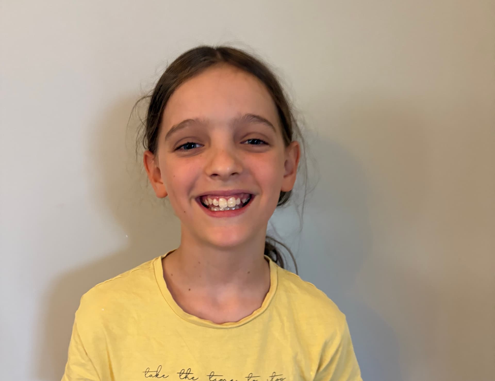 Fastest to Jump 100 Times in FEMALE - 10-12 YEARS OLD - Perth, WA (AU)