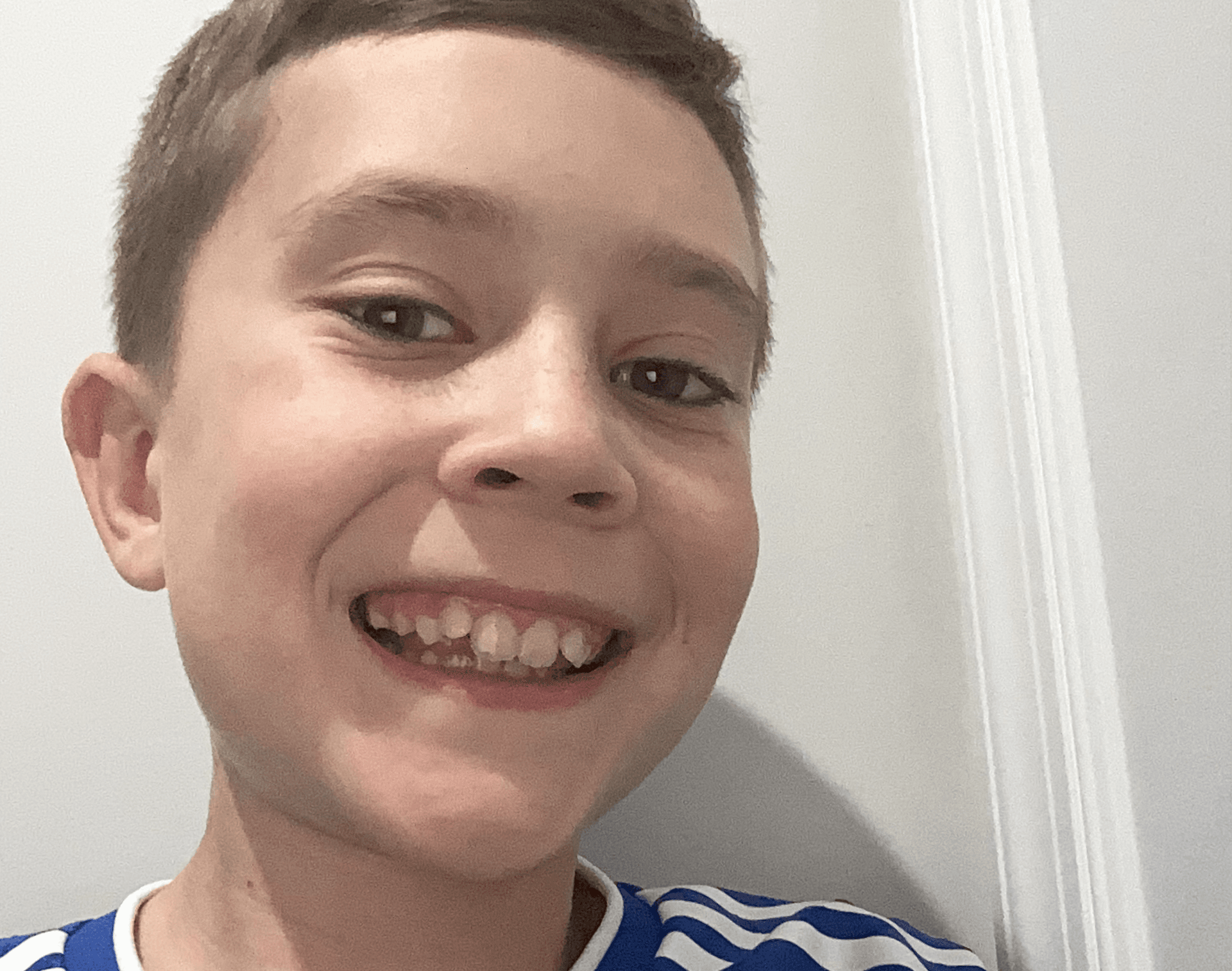 Longest Smile